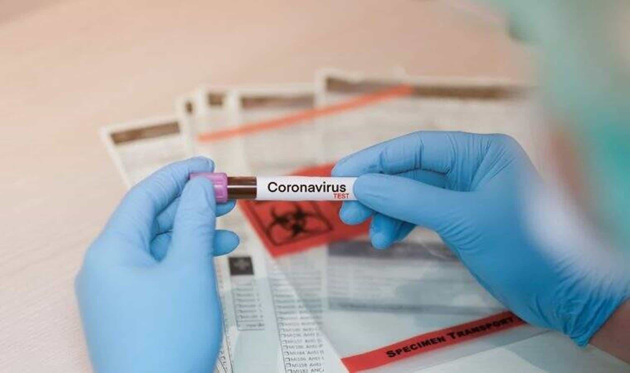 Coronavírus: Brasil chega a marca de 8,13 milhões de casos confirmados