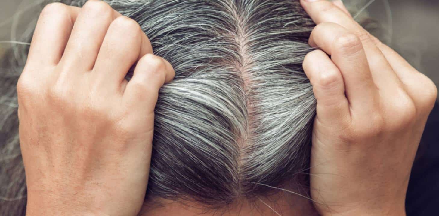 Como se livrar dos fios grisalhos e evitar a queda de cabelo com bicarbonato de sódio