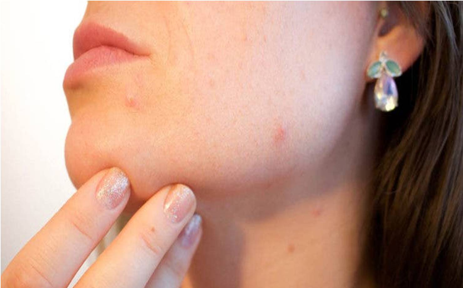 Como o estresse afeta a pele e o que fazer para combatê-lo