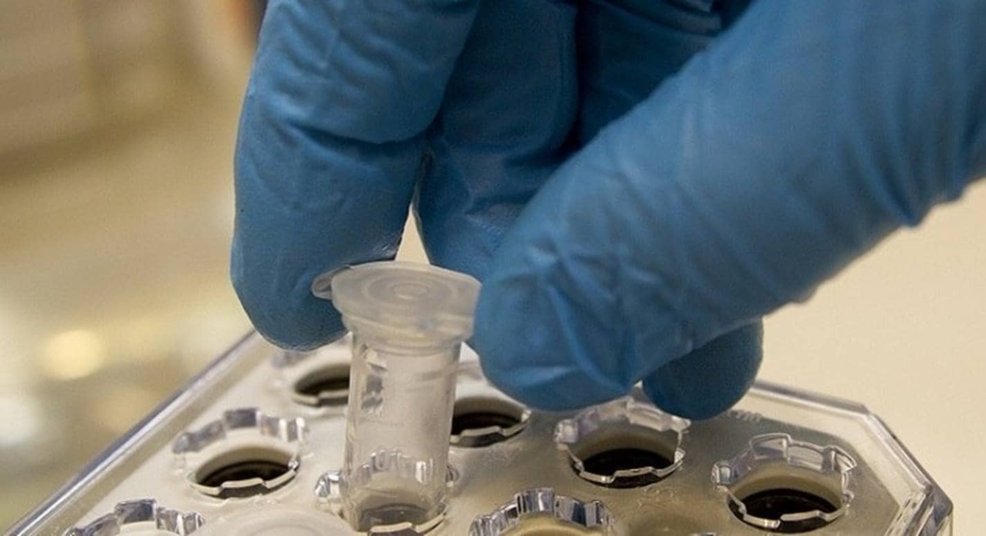 Anvisa autoriza testes do primeiro soro anticovid no Brasil